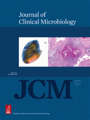 Improving the Sensitivity of the Xpert MTB/RIF Assay on Sputum Pellets by Decreasing the Amount of A