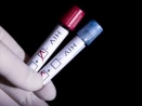 Task force calls for routine HIV testing for all adults - image